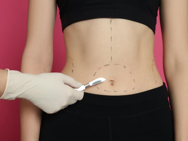 Tratamento Pós-Bariátrica